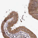 Atlas Antibodies Anti-PRICKLE3 Antibody