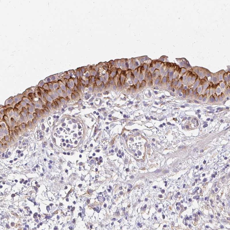 Atlas Antibodies Anti-PRIMA1 Antibody