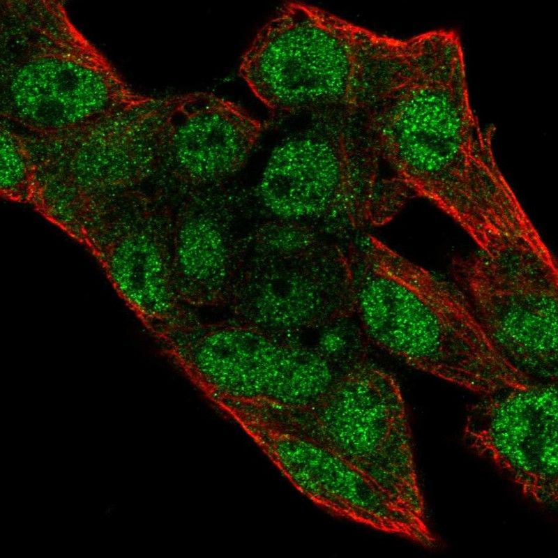 Atlas Antibodies Anti-PRIM2 Antibody