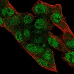 Atlas Antibodies Anti-PRIM2 Antibody