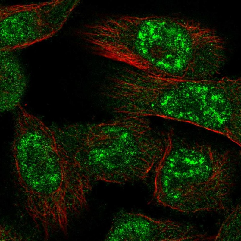 Atlas Antibodies Anti-PRKAA1 Antibody