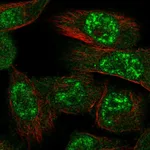 Atlas Antibodies Anti-PRKAA1 Antibody