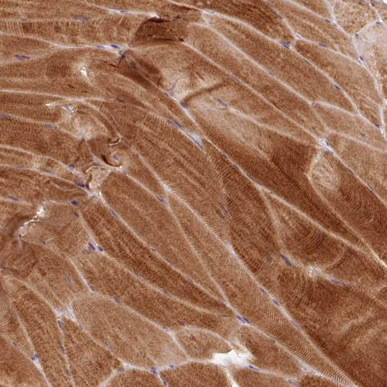 Atlas Antibodies Anti-PRKAA2 Antibody