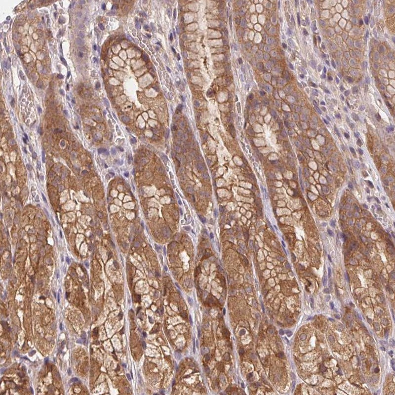 Atlas Antibodies Anti-PRKAA1 Antibody