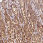 Atlas Antibodies Anti-PRKAA1 Antibody