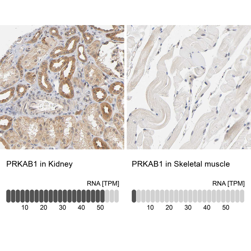 Atlas Antibodies Anti-PRKAB1 Antibody