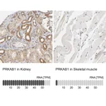 Atlas Antibodies Anti-PRKAB1 Antibody