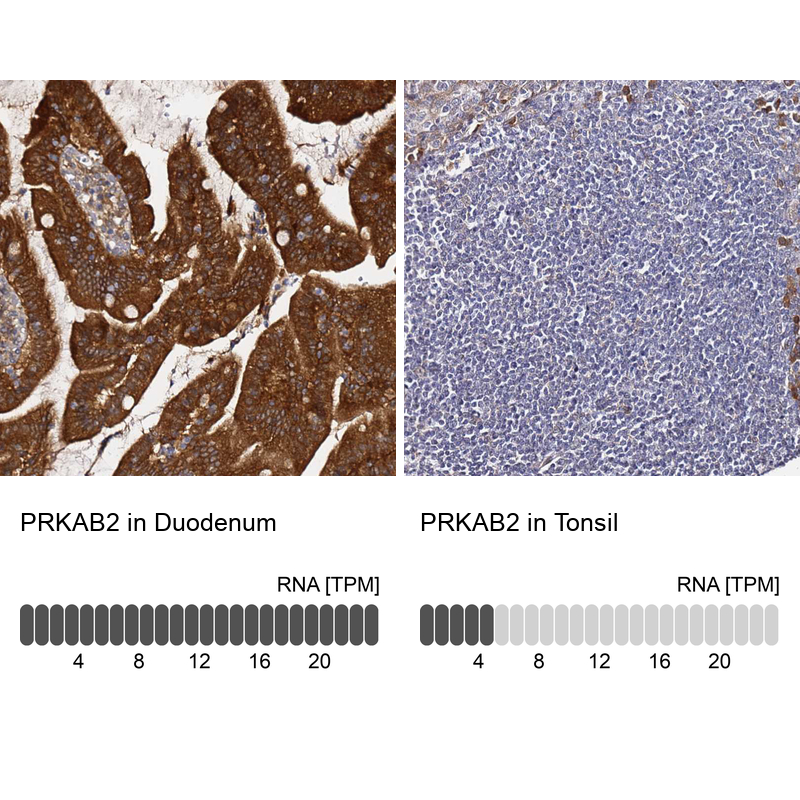 Atlas Antibodies Anti-PRKAB2 Antibody
