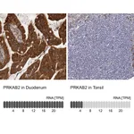 Atlas Antibodies Anti-PRKAB2 Antibody