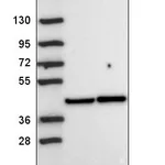 Atlas Antibodies Anti-PRKACA Antibody