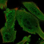 Atlas Antibodies Anti-PRKAG1 Antibody