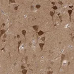 Atlas Antibodies Anti-PRKAR1B Antibody