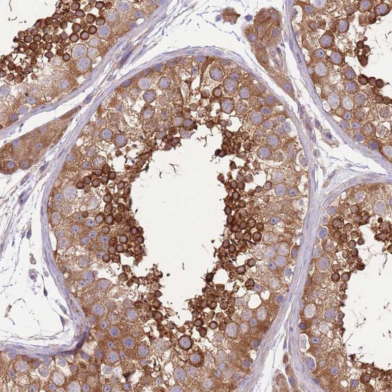 Atlas Antibodies Anti-PRKAR1A Antibody