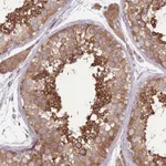 Atlas Antibodies Anti-PRKAR1A Antibody