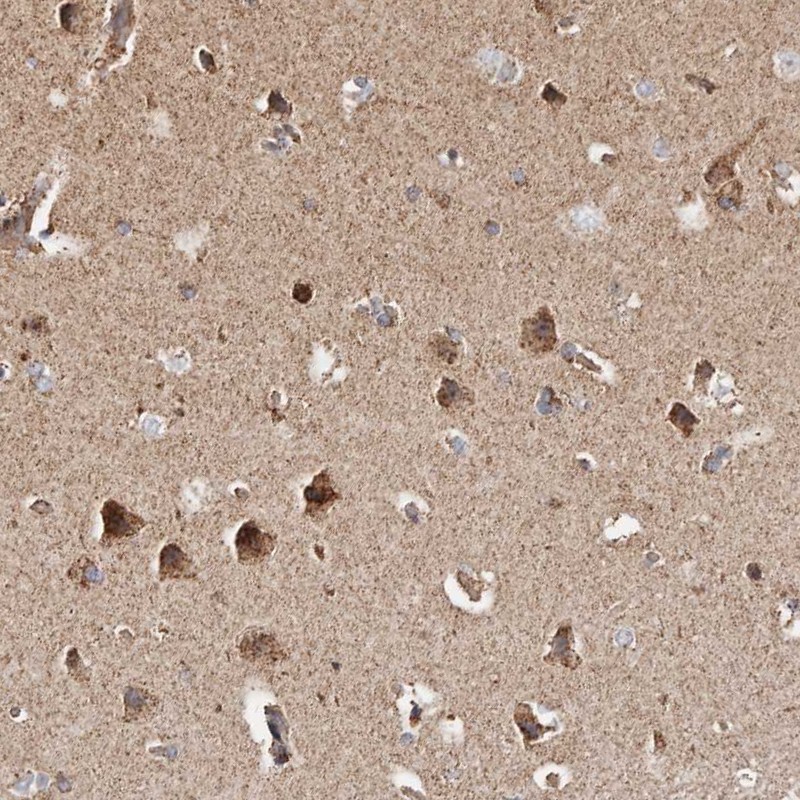 Atlas Antibodies Anti-PRKACB Antibody