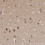Atlas Antibodies Anti-PRKACB Antibody