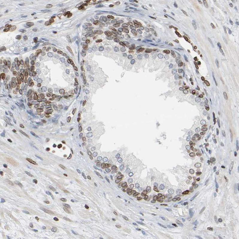 Atlas Antibodies Anti-PRKAG2 Antibody