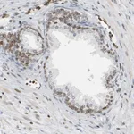 Atlas Antibodies Anti-PRKAG2 Antibody