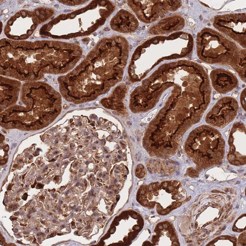 Atlas Antibodies Anti-PRKAR2A Antibody