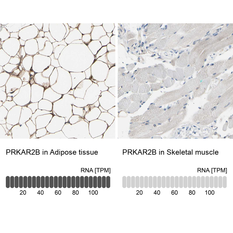 Atlas Antibodies Anti-PRKAR2B Antibody
