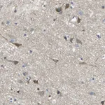 Atlas Antibodies Anti-PRKCA Antibody