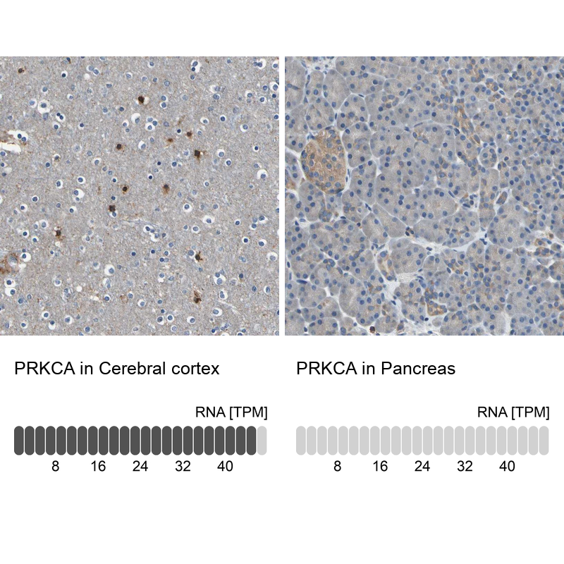 Atlas Antibodies Anti-PRKCA Antibody