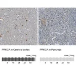Atlas Antibodies Anti-PRKCA Antibody