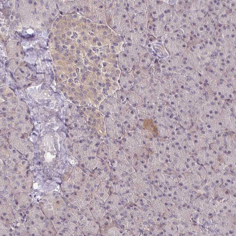 Atlas Antibodies Anti-PRKCB Antibody