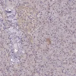 Atlas Antibodies Anti-PRKCB Antibody