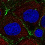 Atlas Antibodies Anti-PRKCDBP Antibody