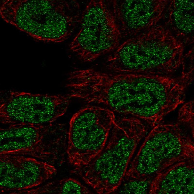 Atlas Antibodies Anti-PRKCB Antibody