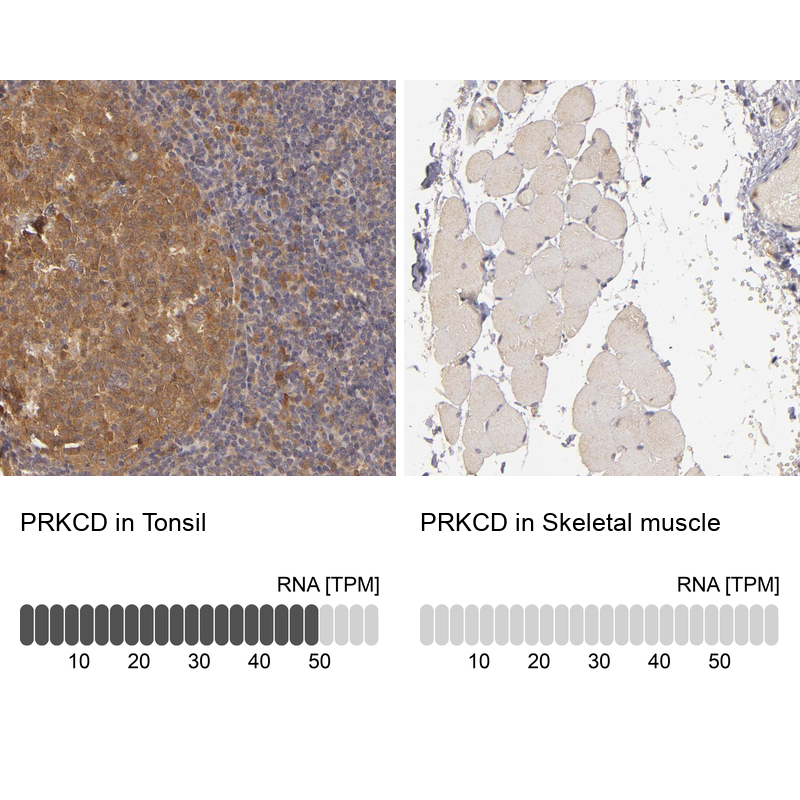 Atlas Antibodies Anti-PRKCD Antibody