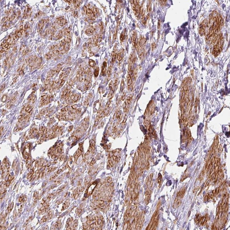Atlas Antibodies Anti-PRKCDBP Antibody