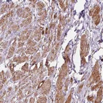 Atlas Antibodies Anti-PRKCDBP Antibody