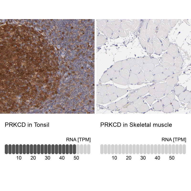 Atlas Antibodies Anti-PRKCD Antibody