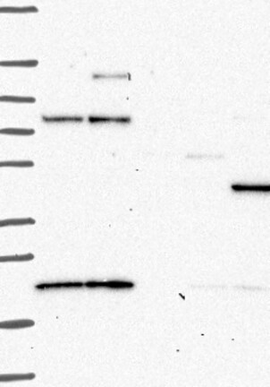 Atlas Antibodies Anti-PRKAR2B Antibody