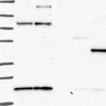 Atlas Antibodies Anti-PRKAR2B Antibody