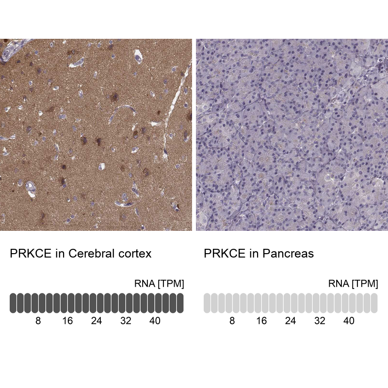 Atlas Antibodies Anti-PRKCE Antibody