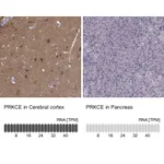 Atlas Antibodies Anti-PRKCE Antibody