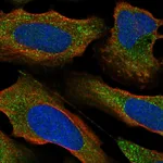 Atlas Antibodies Anti-PRKCE Antibody