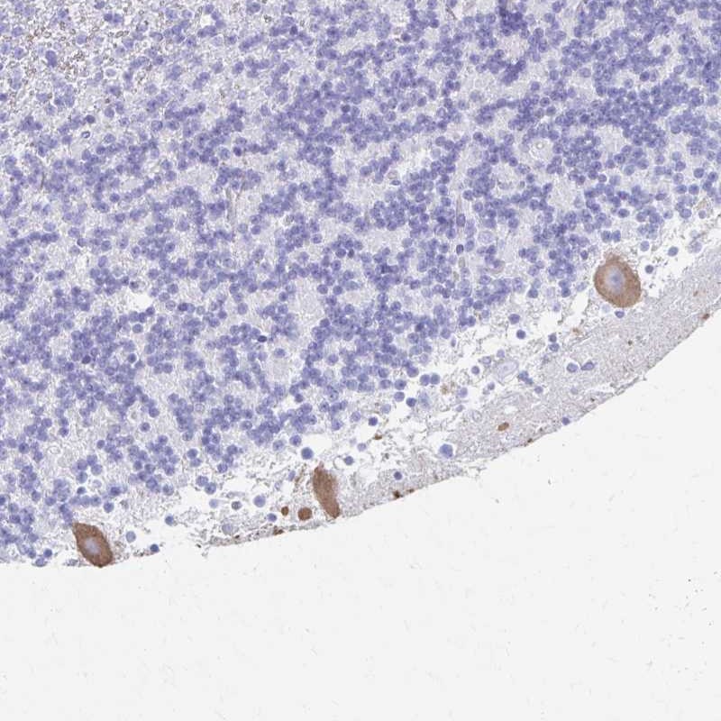 Atlas Antibodies Anti-PRKCG Antibody