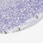 Atlas Antibodies Anti-PRKCG Antibody