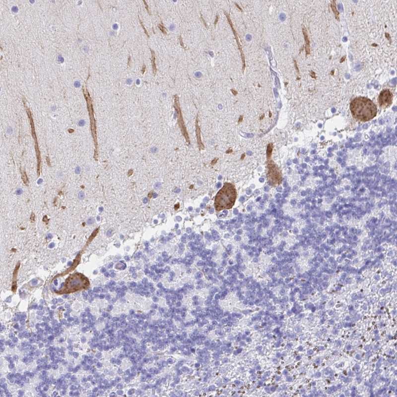 Atlas Antibodies Anti-PRKCG Antibody