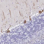 Atlas Antibodies Anti-PRKCG Antibody