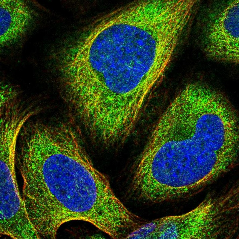 Atlas Antibodies Anti-PRKCI Antibody
