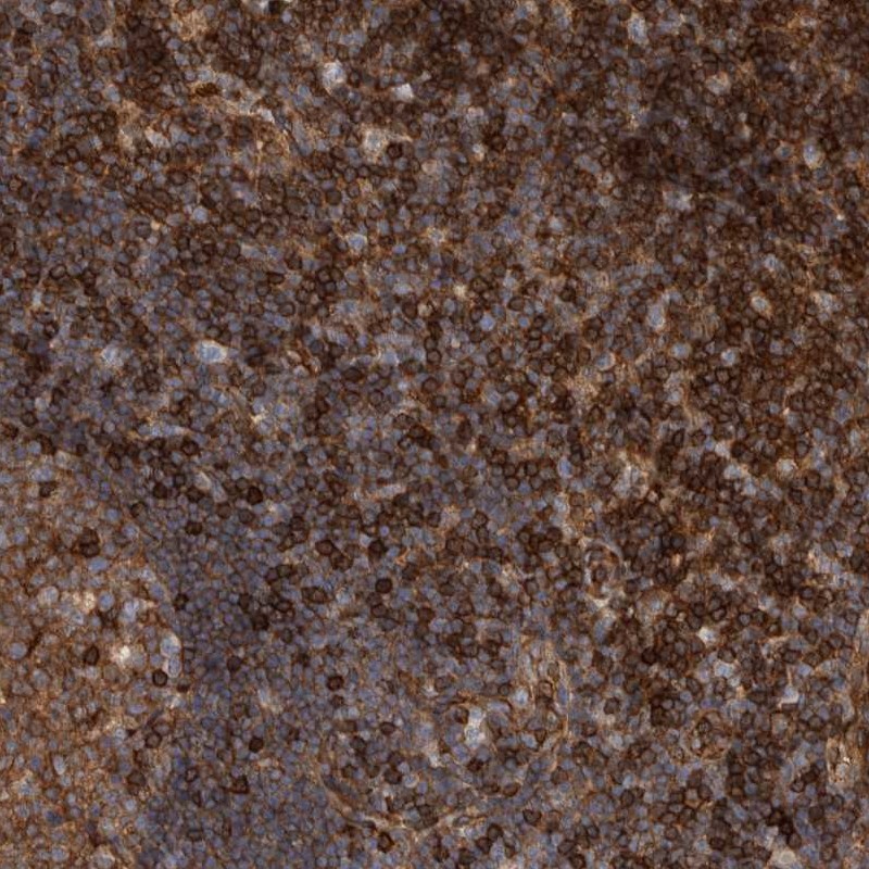 Atlas Antibodies Anti-PRKCH Antibody