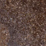 Atlas Antibodies Anti-PRKCH Antibody
