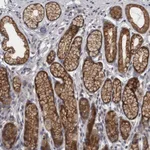 Atlas Antibodies Anti-PRKCI Antibody
