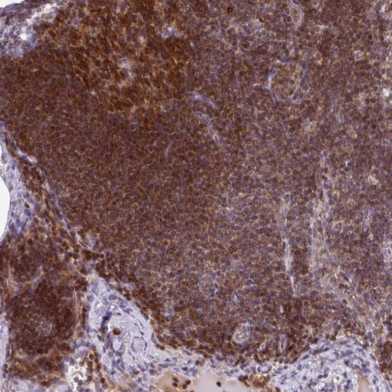 Atlas Antibodies Anti-PRKCH Antibody