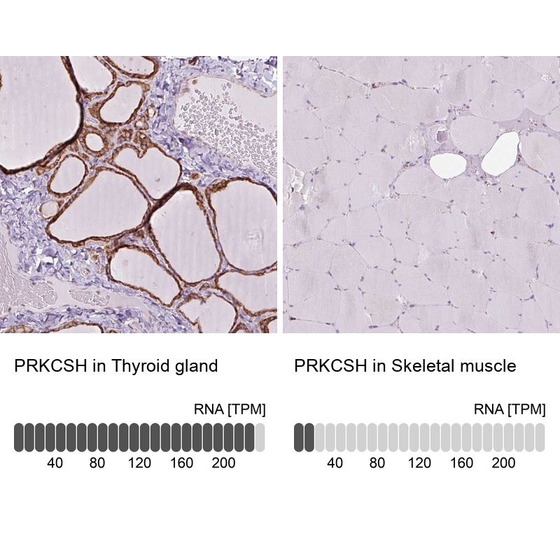 Atlas Antibodies Anti-PRKCSH Antibody